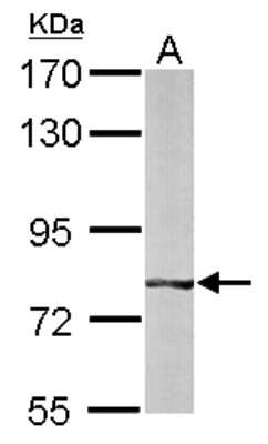 Western Blot: BBS7 Antibody [NBP1-32754]