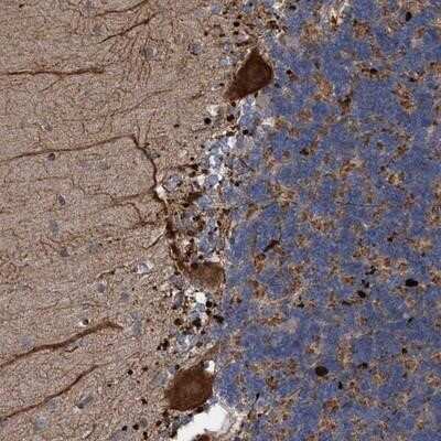 Immunohistochemistry-Paraffin: BBS9 Antibody [NBP1-88927]