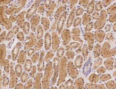 Immunohistochemistry-Paraffin: BBS9 Antibody [NBP3-12584]