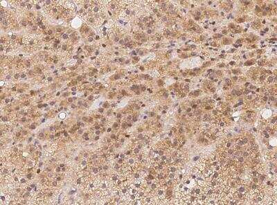 Immunohistochemistry-Paraffin: BBS9 Antibody [NBP3-12584]