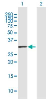 Western Blot: BBS9 Antibody [H00027241-D02P]