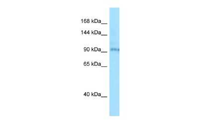 Western Blot: BBS9 Antibody [NBP2-84499]