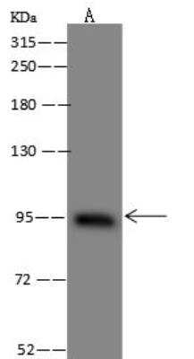 Western Blot: BBS9 Antibody [NBP3-12584]