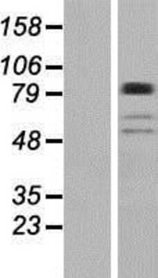 Western Blot: BBS9 Overexpression Lysate [NBP2-04684]