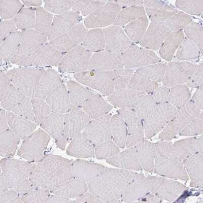 Immunohistochemistry-Paraffin: BCAP/PIK3AP1 Antibody [NBP2-38413]