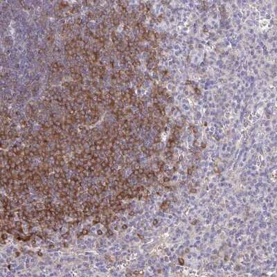 Immunohistochemistry-Paraffin: BCAP/PIK3AP1 Antibody [NBP2-38413]