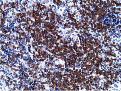 Immunohistochemistry: BCAP/PIK3AP1 Antibody (OTI7A11) - Azide and BSA Free [NBP2-72368]