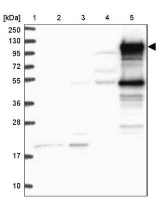 Western Blot: BCAP/PIK3AP1 Antibody [NBP2-38413]