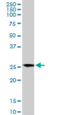 Western Blot: BCAP31 Antibody (3C5) [H00010134-M01]