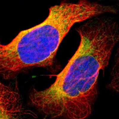 Immunocytochemistry/ Immunofluorescence: BCAP31 Antibody [NBP1-89357]