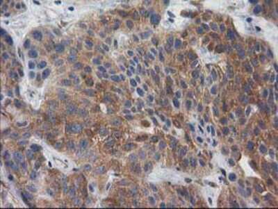 Immunohistochemistry-Paraffin: p130Cas/BCAR1 Antibody (OTI1A9) [NBP2-00532]