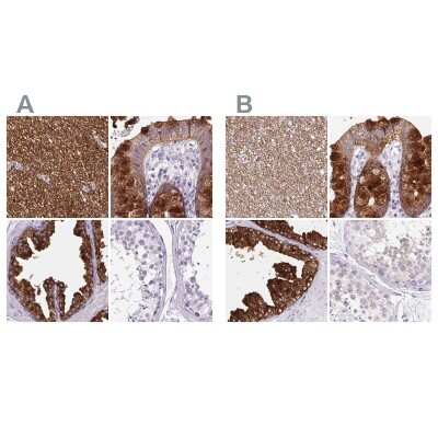 Immunohistochemistry-Paraffin: BCAS1 Antibody [NBP2-38658]