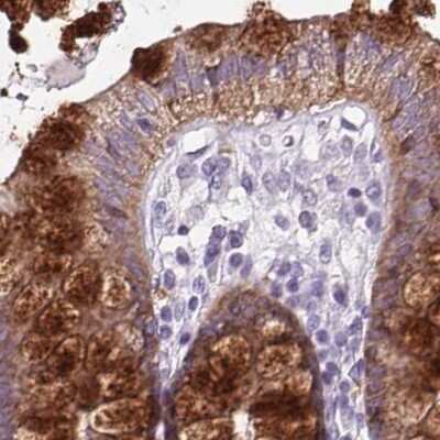 Immunohistochemistry-Paraffin: BCAS1 Antibody [NBP2-38658]