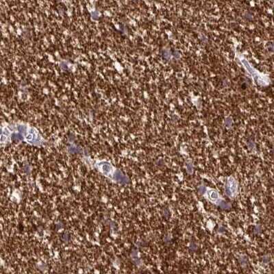 Immunohistochemistry-Paraffin: BCAS1 Antibody [NBP2-38658]
