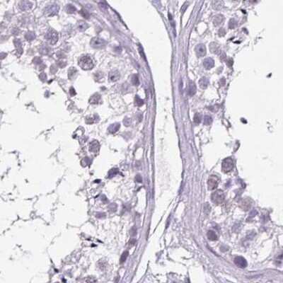Immunohistochemistry-Paraffin: BCAS1 Antibody [NBP2-38658]