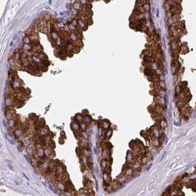 Immunohistochemistry-Paraffin: BCAS1 Antibody [NBP2-38658]