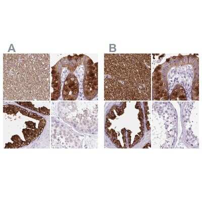 Immunohistochemistry-Paraffin: BCAS1 Antibody [NBP2-38736]