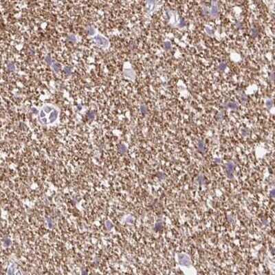 Immunohistochemistry-Paraffin: BCAS1 Antibody [NBP2-38736]