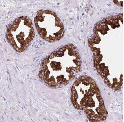 Immunohistochemistry-Paraffin: BCAS1 Antibody [NBP2-38736]