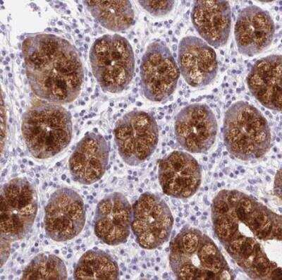 Immunohistochemistry-Paraffin: BCAS1 Antibody [NBP2-38736]