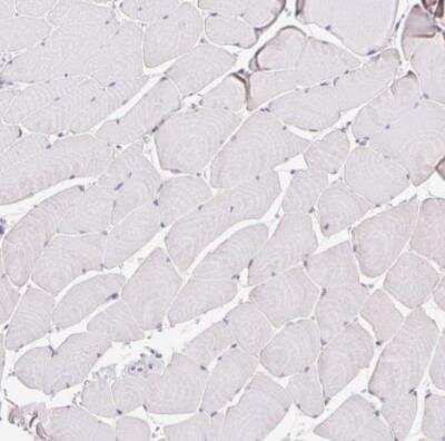 Immunohistochemistry-Paraffin: BCAS1 Antibody [NBP2-38736]