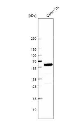 Western Blot: BCAS1 Antibody [NBP2-38736]