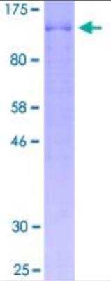 SDS-PAGE: Recombinant Human BCAS1 Protein [H00008537-P01]