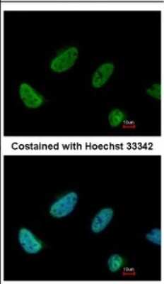 Immunocytochemistry/ Immunofluorescence: BCAS2 Antibody [NBP2-15551]