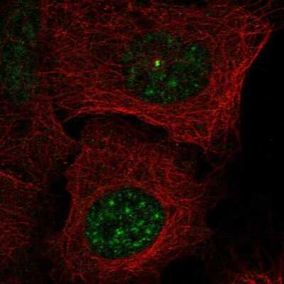 Immunocytochemistry/ Immunofluorescence: BCAS2 Antibody [NBP2-49532]