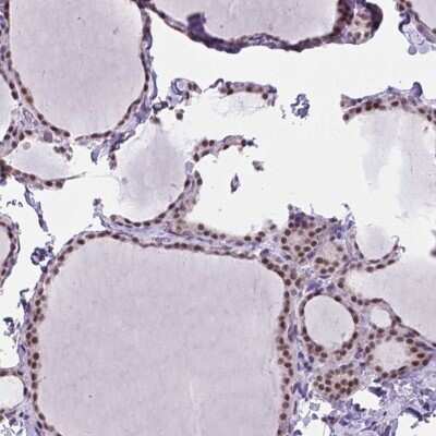 Immunohistochemistry-Paraffin: BCAS2 Antibody [NBP2-49532]