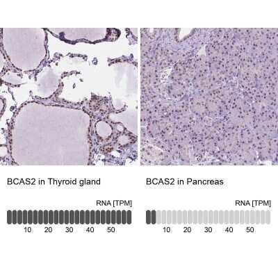 Immunohistochemistry-Paraffin: BCAS2 Antibody [NBP2-49532]