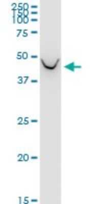 Western Blot: BCAT1 Antibody (1F8) [H00000586-M02]
