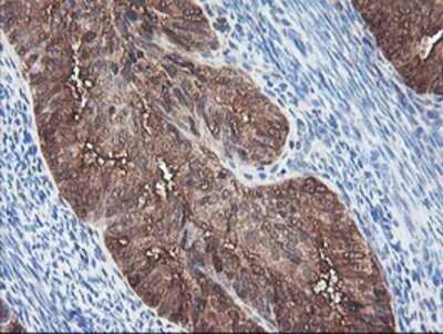 Immunohistochemistry: BCAT1 Antibody (OTI3F5) - Azide and BSA Free [NBP2-70242]