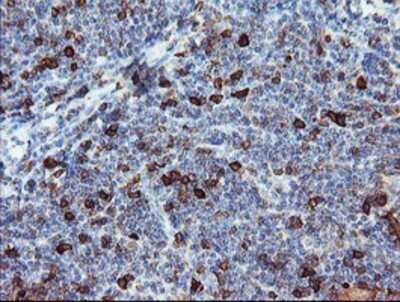 Immunohistochemistry: BCAT1 Antibody (OTI3F5) - Azide and BSA Free [NBP2-70242]