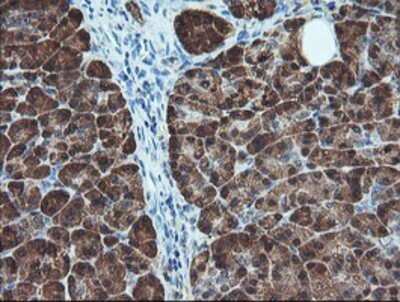 Immunohistochemistry: BCAT1 Antibody (OTI3F5) - Azide and BSA Free [NBP2-70242]