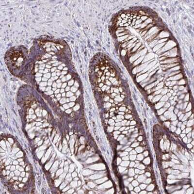 Immunohistochemistry-Paraffin: BCAT2 Antibody [NBP2-33705]