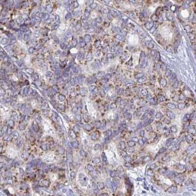 Immunohistochemistry-Paraffin: BCAT2 Antibody [NBP2-33705]