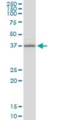 Western Blot: BCAT2 Antibody [H00000587-B01P]