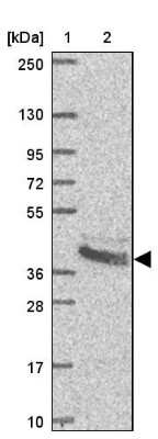 Western Blot: BCAT2 Antibody [NBP2-33705]