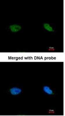 Immunocytochemistry/ Immunofluorescence: BCCIP Antibody [NBP1-31319]