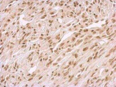 Immunohistochemistry-Paraffin: BCCIP Antibody [NBP1-31319]