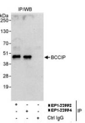 Immunoprecipitation: BCCIP Antibody [NBP1-22994]