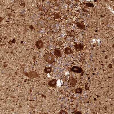Immunohistochemistry-Paraffin: BCDIN3D Antibody [NBP1-85857]