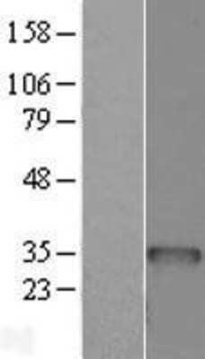 Western Blot: BCDIN3D Overexpression Lysate [NBL1-07941]