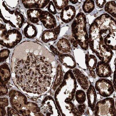 Immunohistochemistry-Paraffin: BCKDHA Antibody [NBP1-81022]