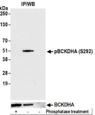 Immunoprecipitation: BCKDHA Antibody (BLR060F) [NBP3-14681]