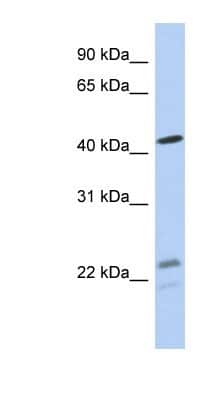 Western Blot: BCKDHA Antibody [NBP1-79616]