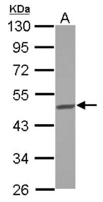 Western Blot: BCKDHA Antibody [NBP2-15552]