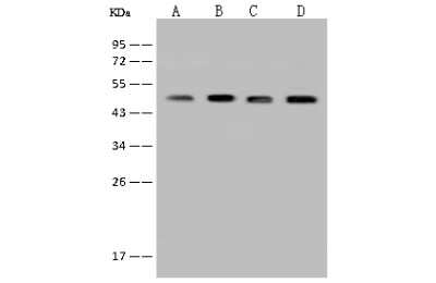 Western Blot: BCKDHA Antibody [NBP2-97503]