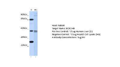 Western Blot: BCKDHB Antibody [NBP2-84500]